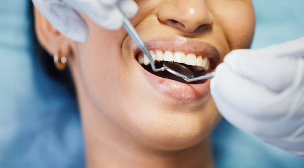 Best Teeth Whitening  in Canyon, TX