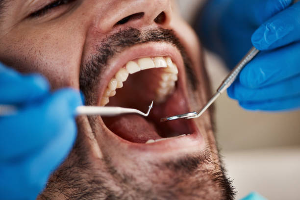 Best Emergency Tooth Extraction  in Canyon, TX